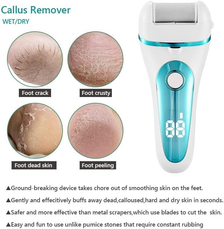 🦶 Electric Foot Callus Remover with LED Light – PicknPro UAE